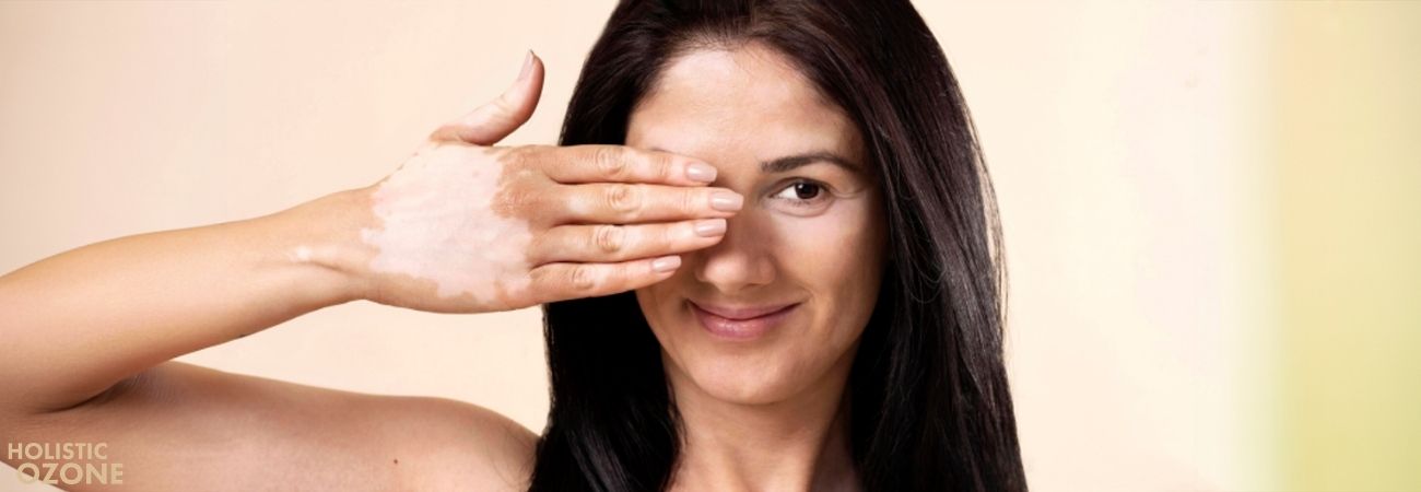 Cilt Tonu Eşitsizliği Nasıl Giderilir?